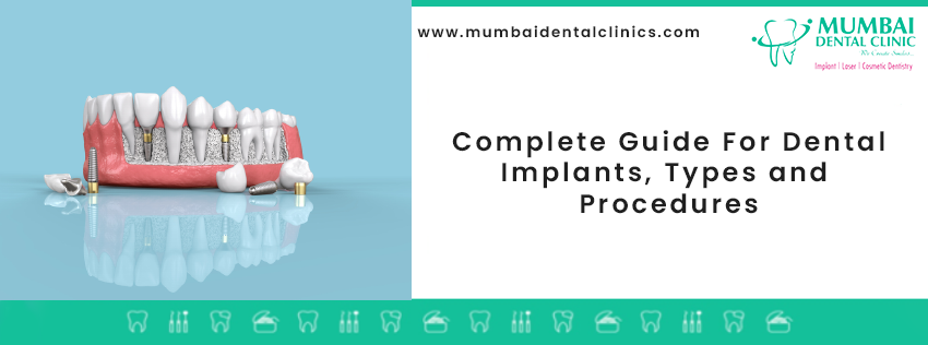 Dental Implant - Preparation, Steps and Results
